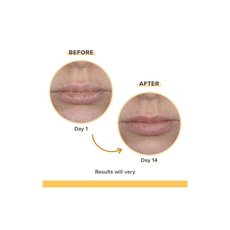 Load image into Gallery viewer, Burt's Bees Cooling Eucalyptus Rescue Balm